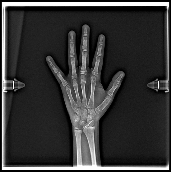 RX DE MANO (1) (1)